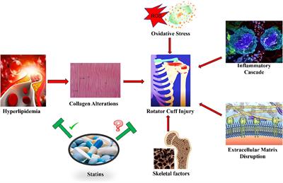Progress in studying the impact of hyperlipidemia and statins on rotator cuff injury and repair